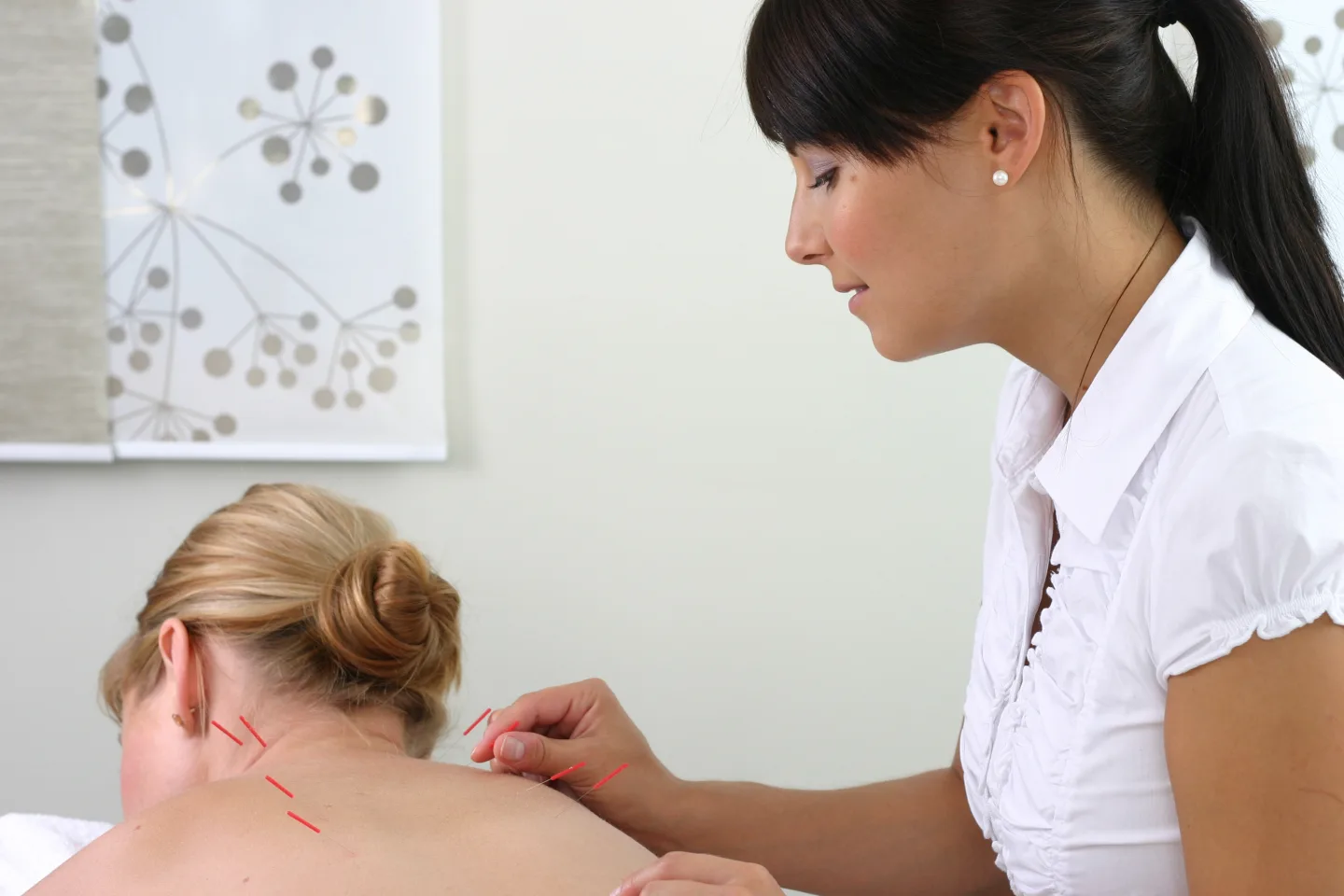 Acupuncture education at NYCHP